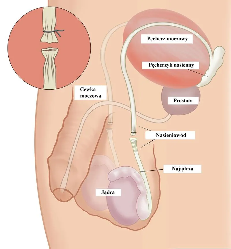 Etyka reprodukcyjna w katolicyzmie